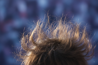 Des cheveux avec de l'électricité statique
